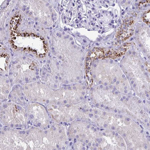 Immunohistochemistry (Formalin/PFA-fixed paraffin-embedded sections) - Anti-CPVL antibody (AB204553)