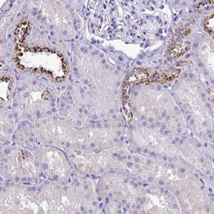 Immunohistochemistry (Formalin/PFA-fixed paraffin-embedded sections) - Anti-CPVL antibody (AB204553)