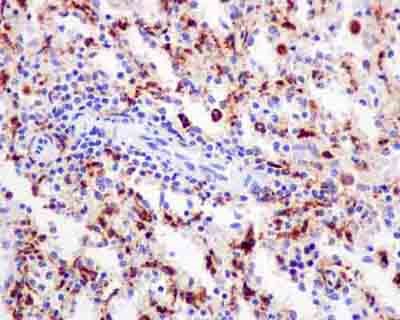 Immunohistochemistry (Formalin/PFA-fixed paraffin-embedded sections) - Anti-CPVL antibody [EPR13153] - BSA and Azide free (AB250156), expandable thumbnail