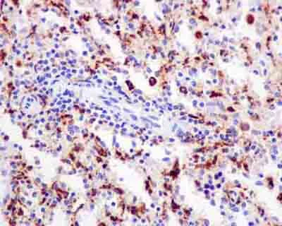 Immunohistochemistry (Formalin/PFA-fixed paraffin-embedded sections) - Anti-CPVL antibody [EPR13153] - BSA and Azide free (AB250156)
