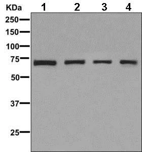 Western blot - Anti-CR1L antibody [EPR9604(B)] (AB169543)