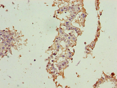 Immunohistochemistry (Formalin/PFA-fixed paraffin-embedded sections) - Anti-CRABP1 antibody (AB235838), expandable thumbnail