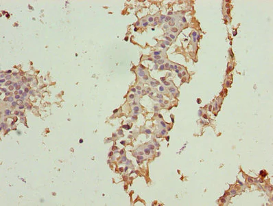 Immunohistochemistry (Formalin/PFA-fixed paraffin-embedded sections) - Anti-CRABP1 antibody (AB235838)