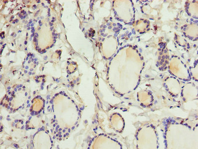 Immunohistochemistry (Formalin/PFA-fixed paraffin-embedded sections) - Anti-CRABP1 antibody (AB235838), expandable thumbnail