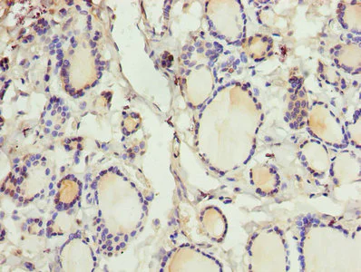 Immunohistochemistry (Formalin/PFA-fixed paraffin-embedded sections) - Anti-CRABP1 antibody (AB235838)