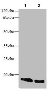 Western blot - Anti-CRABP1 antibody (AB235838), expandable thumbnail