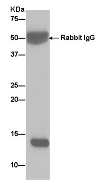 Immunoprecipitation - Anti-CRABP1 antibody [EPR7905] (AB182573)
