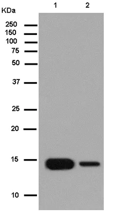 Western blot - Anti-CRABP1 antibody [EPR7905] (AB182573)