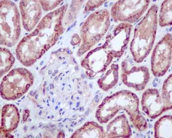 Immunohistochemistry (Formalin/PFA-fixed paraffin-embedded sections) - Anti-CRABP2 antibody [EPR14256(B)] (AB181255)
