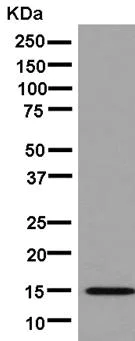 Western blot - Anti-CRABP2 antibody [EPR14256(B)] (AB181255)