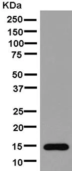Western blot - Anti-CRABP2 antibody [EPR14256(B)] (AB181255)