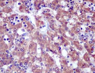 Immunohistochemistry (Formalin/PFA-fixed paraffin-embedded sections) - Anti-CRABP2 antibody [EPR14256(B)] - BSA and Azide free (AB250468)