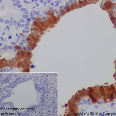 Immunohistochemistry (Formalin/PFA-fixed paraffin-embedded sections) - Anti-CRABP2 antibody [EPR17376] (AB211927)
