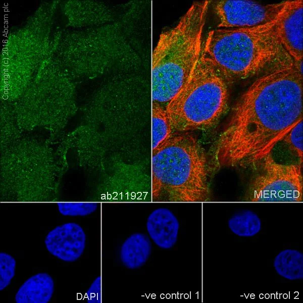 Immunocytochemistry/ Immunofluorescence - Anti-CRABP2 antibody [EPR17376] - BSA and Azide free (AB223551)