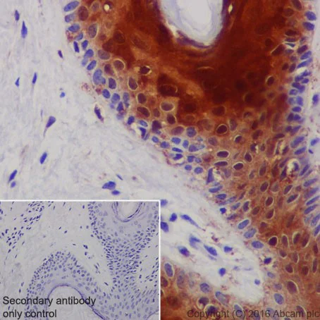 Immunohistochemistry (Formalin/PFA-fixed paraffin-embedded sections) - Anti-CRABP2 antibody [EPR17376] - BSA and Azide free (AB223551)