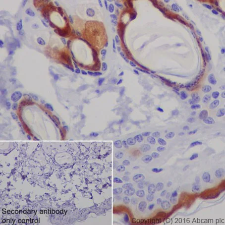 Immunohistochemistry (Formalin/PFA-fixed paraffin-embedded sections) - Anti-CRABP2 antibody [EPR17376] - BSA and Azide free (AB223551)