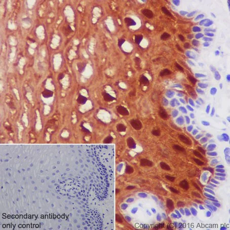 Immunohistochemistry (Formalin/PFA-fixed paraffin-embedded sections) - Anti-CRABP2 antibody [EPR17376] - BSA and Azide free (AB223551)