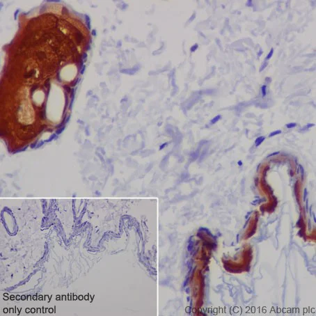 Immunohistochemistry (Formalin/PFA-fixed paraffin-embedded sections) - Anti-CRABP2 antibody [EPR17376] - BSA and Azide free (AB223551)