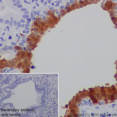 Immunohistochemistry (Formalin/PFA-fixed paraffin-embedded sections) - Anti-CRABP2 antibody [EPR17376] - BSA and Azide free (AB223551)
