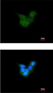 Immunocytochemistry/ Immunofluorescence - Anti-CRALBP antibody (AB154898), expandable thumbnail