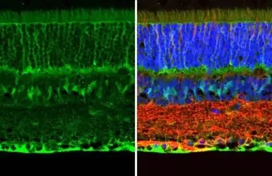 Immunohistochemistry (Formalin/PFA-fixed paraffin-embedded sections) - Anti-CRALBP antibody (AB154898)