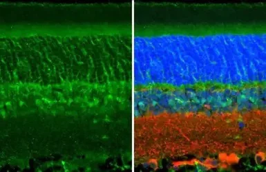 Immunohistochemistry (Formalin/PFA-fixed paraffin-embedded sections) - Anti-CRALBP antibody (AB154898)