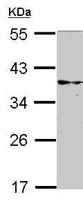 Western blot - Anti-CRALBP antibody (AB154898), expandable thumbnail