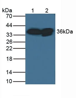 Western blot - Anti-CRALBP antibody (AB231967)