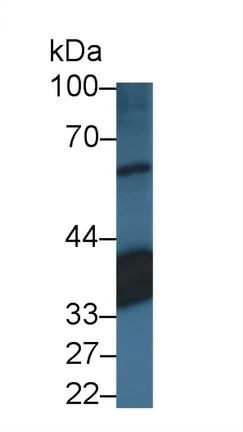 Western blot - Anti-CRALBP antibody (AB231967)