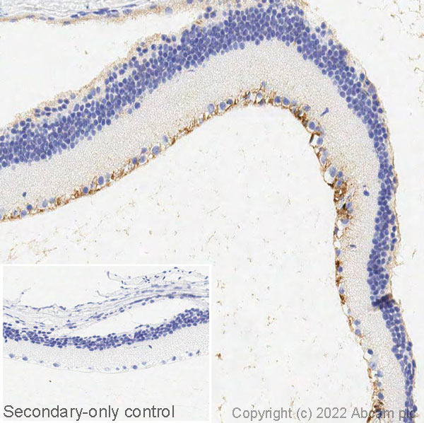Immunohistochemistry (Formalin/PFA-fixed paraffin-embedded sections) - Anti-CRALBP antibody [B2] (AB15051)