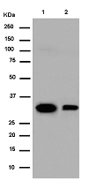 Western blot - Anti-CRALBP antibody [EPR13801] (AB183728)