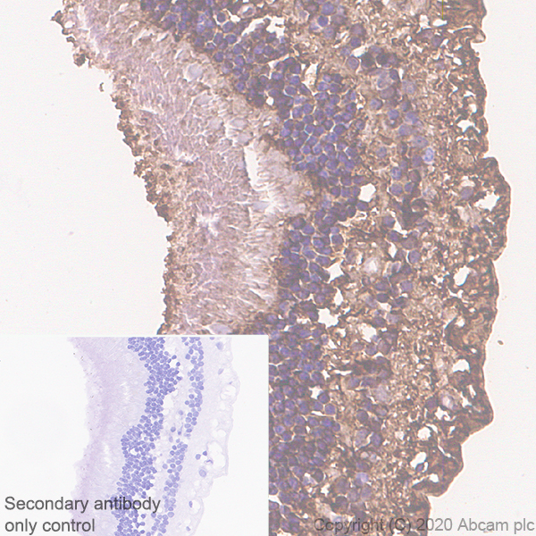Immunohistochemistry (Formalin/PFA-fixed paraffin-embedded sections) - Anti-CRALBP antibody [EPR23448-119] (AB243664), expandable thumbnail