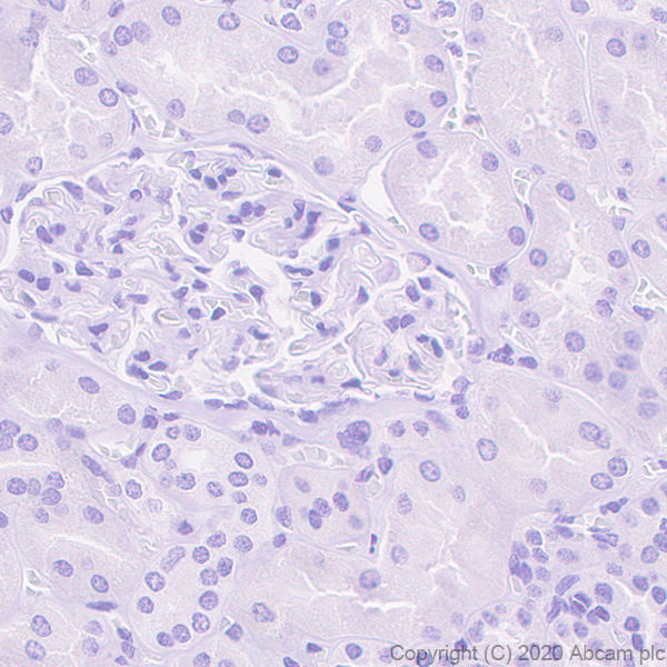 Immunohistochemistry (Formalin/PFA-fixed paraffin-embedded sections) - Anti-CRALBP antibody [EPR23448-119] (ab243664), expandable thumbnail