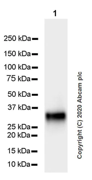 Western blot - Anti-CRALBP antibody [EPR23448-119] (AB243664)