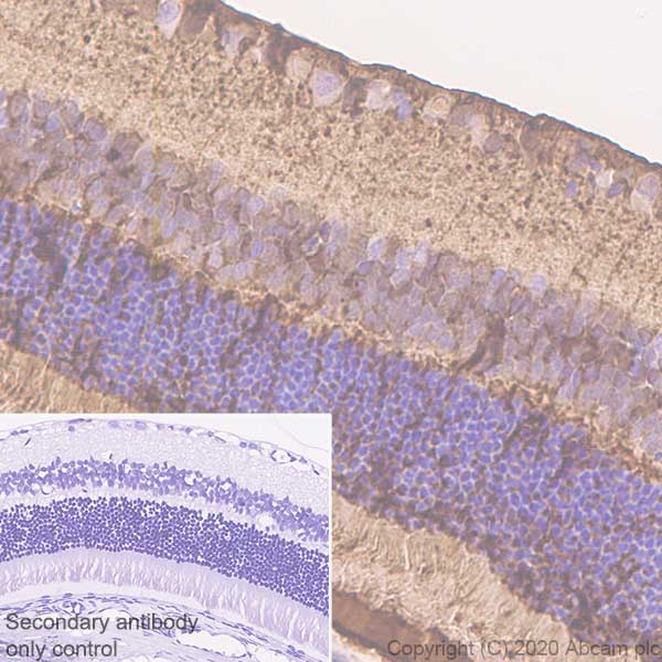 Immunohistochemistry (Formalin/PFA-fixed paraffin-embedded sections) - Anti-CRALBP antibody [EPR23448-119] - BSA and Azide free (AB272171), expandable thumbnail