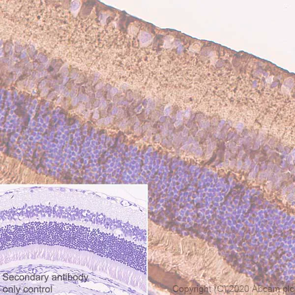 Immunohistochemistry (Formalin/PFA-fixed paraffin-embedded sections) - Anti-CRALBP antibody [EPR23448-119] - BSA and Azide free (AB272171)
