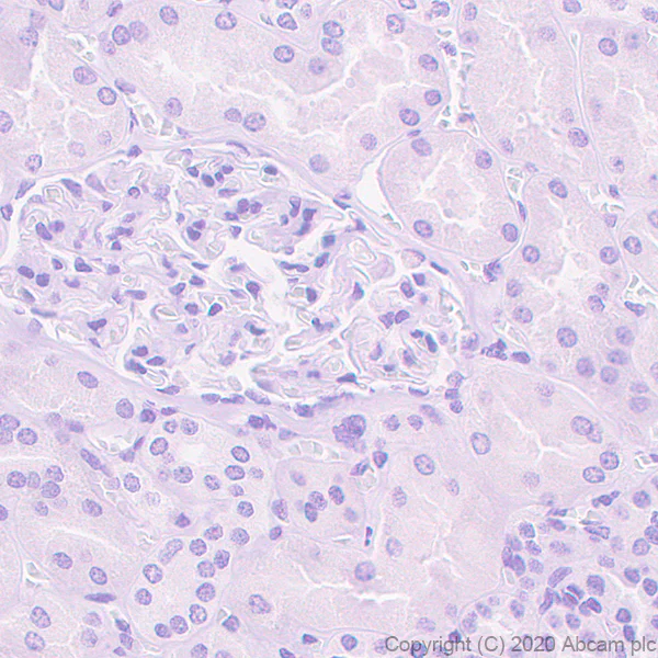 Immunohistochemistry (Formalin/PFA-fixed paraffin-embedded sections) - Anti-CRALBP antibody [EPR23448-119] - BSA and Azide free (AB272171)