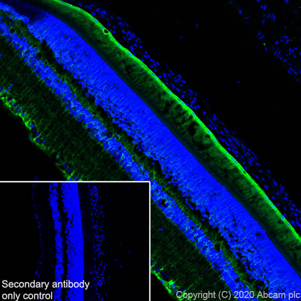 Immunohistochemistry (Frozen sections) - Anti-CRALBP antibody [EPR23448-119] - BSA and Azide free (ab272171), expandable thumbnail
