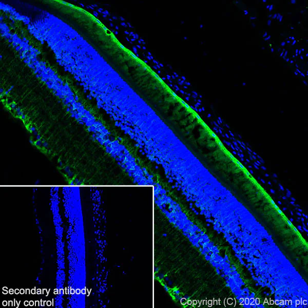 Immunohistochemistry (Frozen sections) - Anti-CRALBP antibody [EPR23448-119] - BSA and Azide free (AB272171)