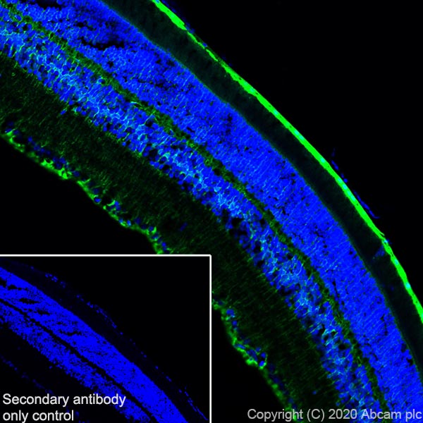 Immunohistochemistry (Frozen sections) - Anti-CRALBP antibody [EPR23448-119] - BSA and Azide free (AB272171), expandable thumbnail
