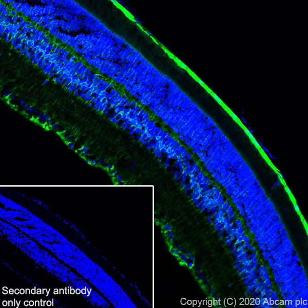 Immunohistochemistry (Frozen sections) - Anti-CRALBP antibody [EPR23448-119] - BSA and Azide free (AB272171)