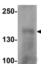 Western blot - Anti-CRB1 antibody (AB156282)