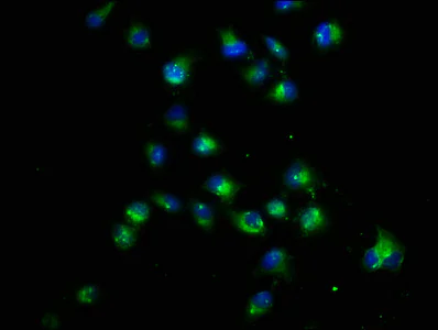 Immunocytochemistry/ Immunofluorescence - Anti-CRB1 antibody (AB238501)