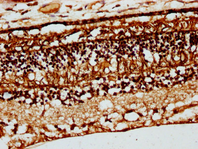 Immunohistochemistry (Formalin/PFA-fixed paraffin-embedded sections) - Anti-CRB1 antibody (AB238501), expandable thumbnail