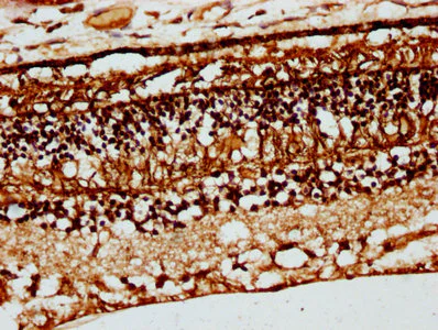 Immunohistochemistry (Formalin/PFA-fixed paraffin-embedded sections) - Anti-CRB1 antibody (AB238501)