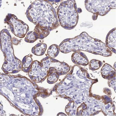 Immunohistochemistry (Formalin/PFA-fixed paraffin-embedded sections) - Anti-CRB2 antibody (AB126373)