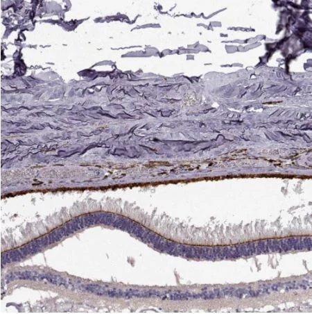 Immunohistochemistry (Formalin/PFA-fixed paraffin-embedded sections) - Anti-CRB2 antibody (AB126373)