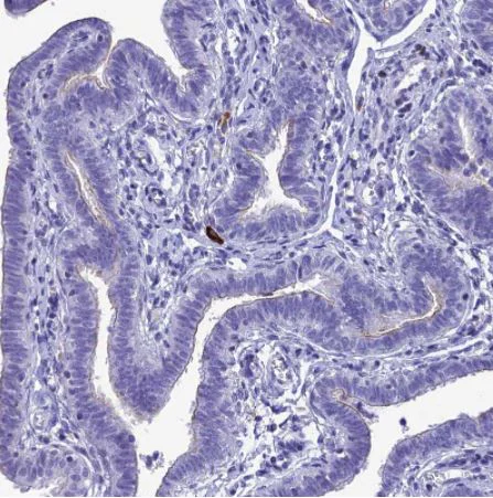 Immunohistochemistry (Formalin/PFA-fixed paraffin-embedded sections) - Anti-CRB2 antibody (AB126373)