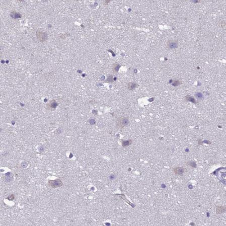 Immunohistochemistry (Formalin/PFA-fixed paraffin-embedded sections) - Anti-CRB2 antibody (AB126373)