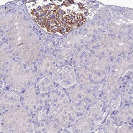 Immunohistochemistry (Formalin/PFA-fixed paraffin-embedded sections) - Anti-CRB2 antibody (AB126373)